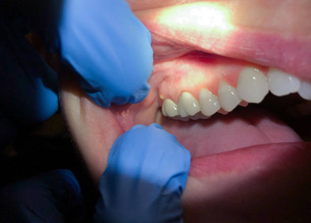 Best Mobile Emergency Dentist in Paris, TN
